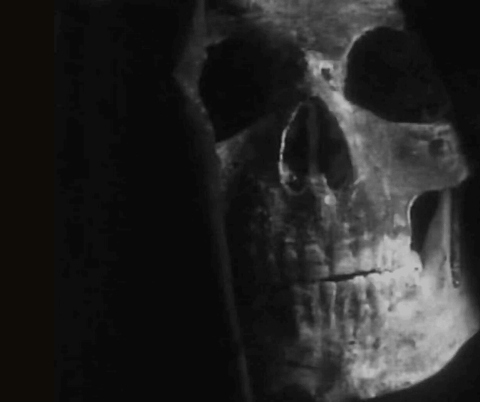 The Stalls of Barchester